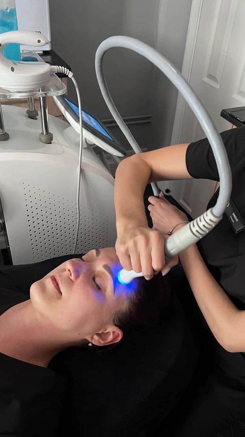 RF Skin Tightening treatment