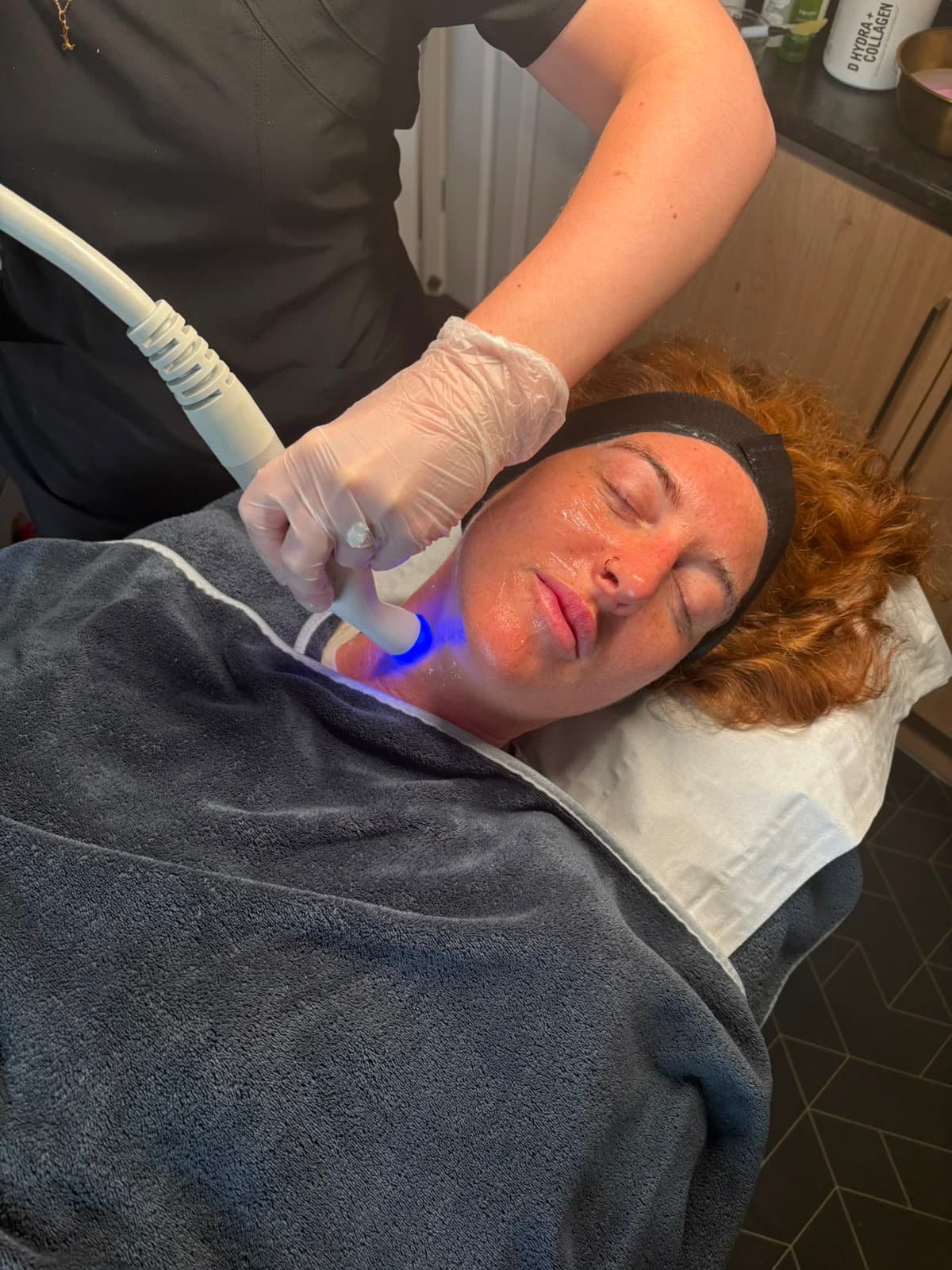 RF Skin Tightening at Olive Beauty & Aesthetics