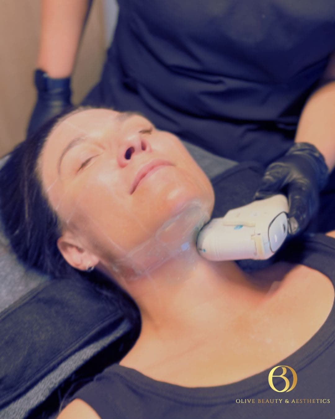 HIFU at Olive Beauty