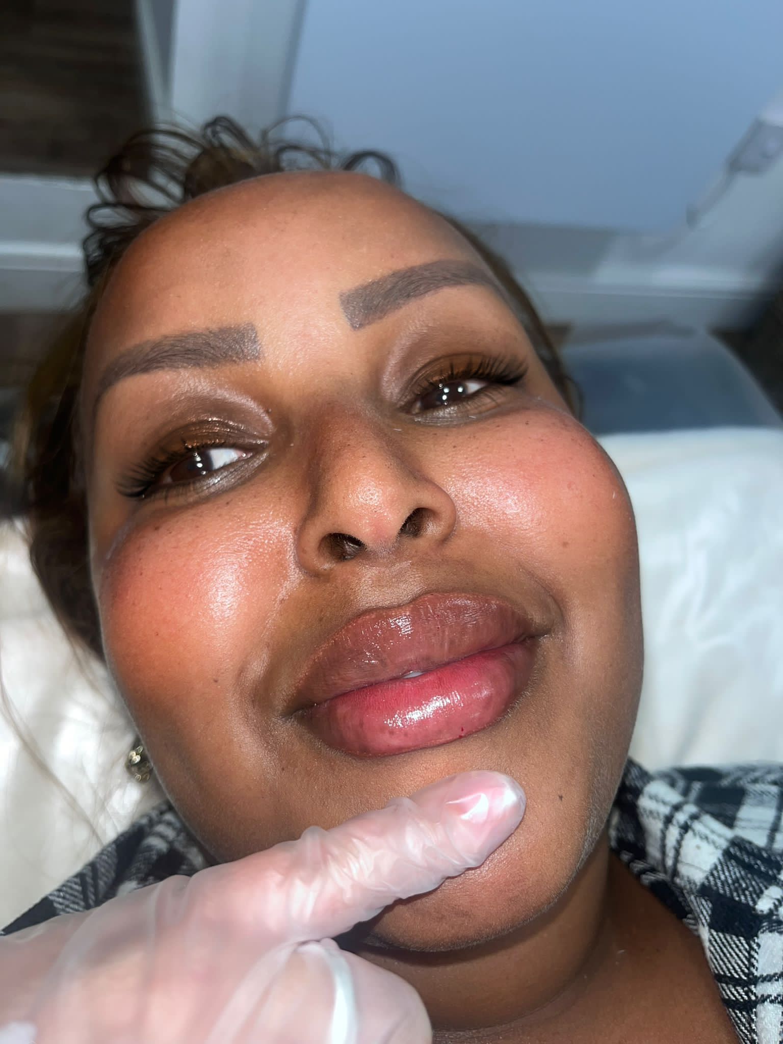 Aesthetic Injectables treatment