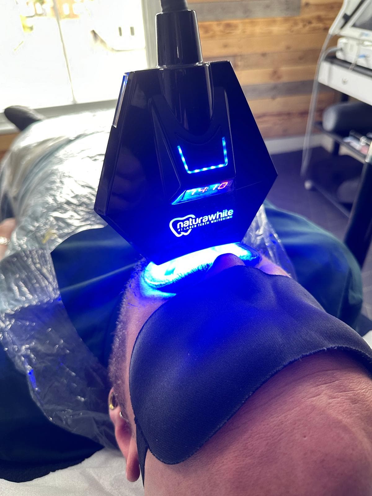 Laser Teeth Whitening at Olive Beauty